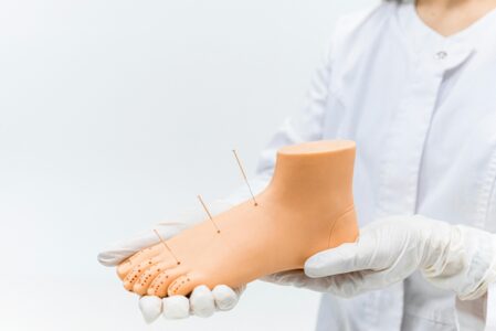 Chirurgia podologiczna Poznań – specjalistyczne zabiegi dla zdrowych stóp